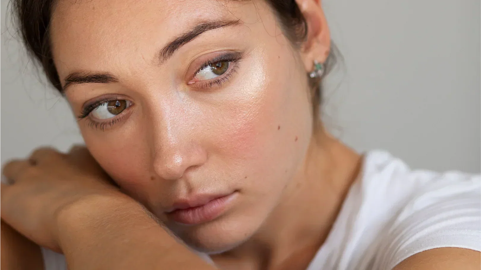 Femme aux yeux bruns, portant une chemise blanche, avec un teint terne.
