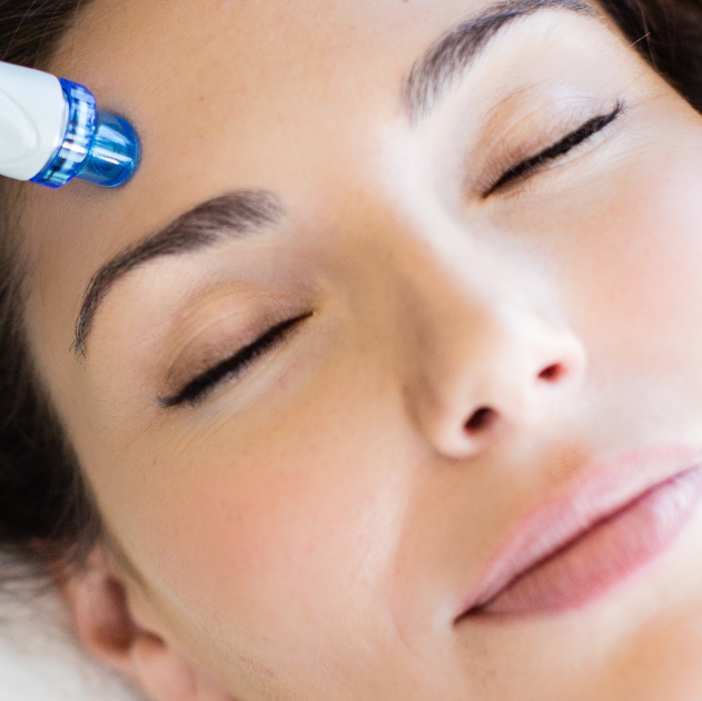 Soin du visage Hydrafacial en clinique chez SK Dermo Esthétique Sherbrooke pour nettoyer, exfolier et hydrater la peau en profondeur.